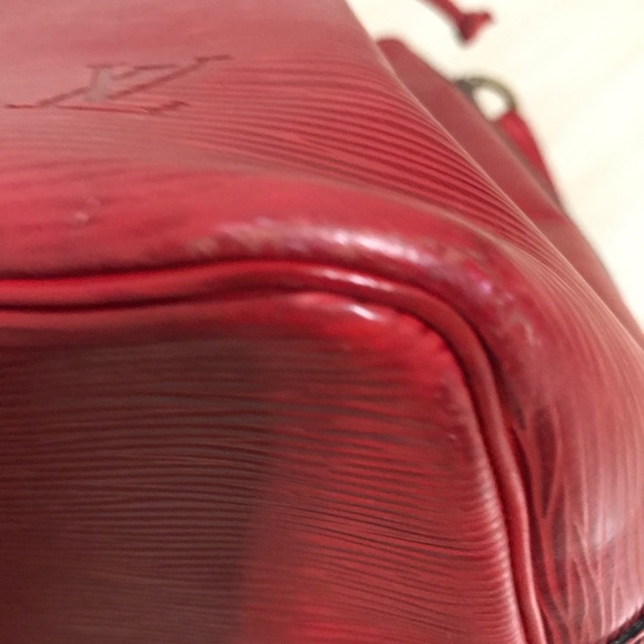 LV Epi Noe🌹 - Picture 7 of 15